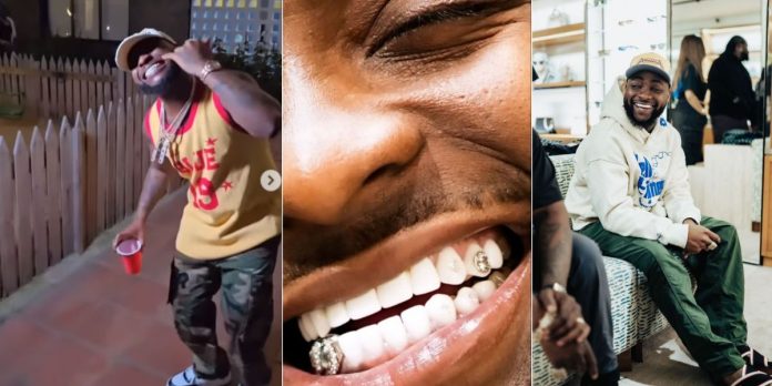 Davido brags as he shows off his N800 million (0k) diamond teeth